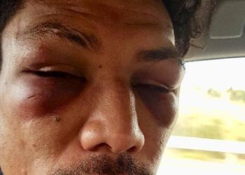 Une recrue de La Rochelle tabassée par un coéquipier