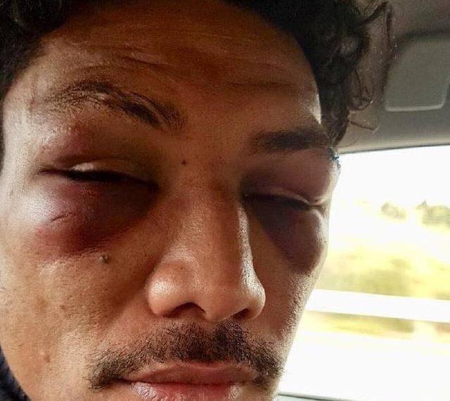 Une recrue de La Rochelle tabassée par un coéquipier