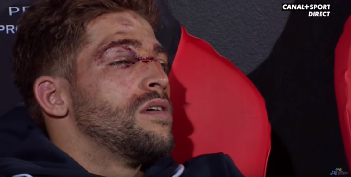 Vidéo: L’impressionnante blessure au visage de Teddy Iribaren