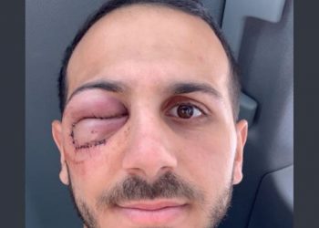 Âmes sensibles s’abstenir : Kylian Hamdaoui défiguré après son télescopage avec Tony Ensor